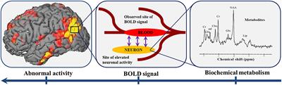 Neuroplasticity of Glioma Patients: Brain Structure and Topological Network